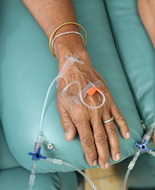 Chemioterapia e aumento di peso, il problema potrebbe risiedere nella disbiosi